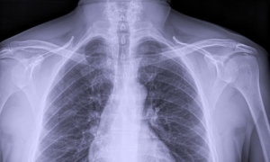 Asbestos: lawyers and doctor guilty
